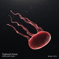 Typhoid Fever - Salmonella Typhi