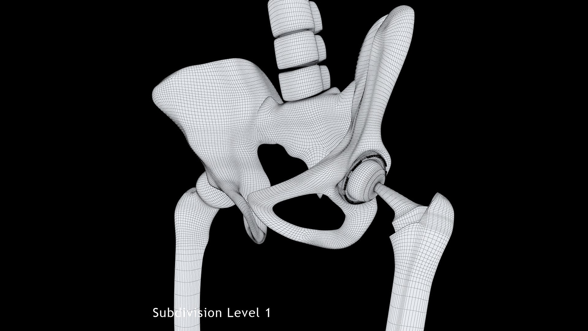 3ds femoral prosthesis tibia pelvis https://p.turbosquid.com/ts-thumb/G1/fKTkdO/20/19/jpg/1662651267/1920x1080/fit_q87/461f27fe0bdd2584ebb211606658d43f3a9b5b27/19.jpg