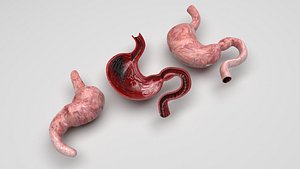 3D Stomach and Stomach Section