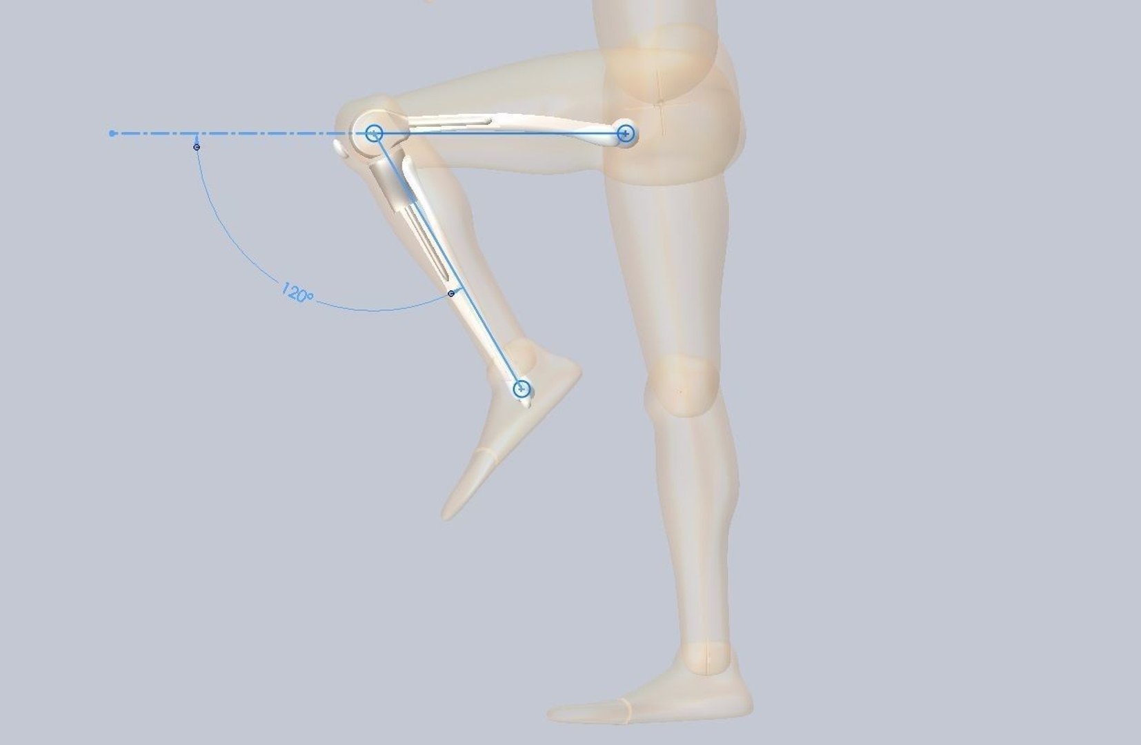 knee tumor prosthesis 3D https://p.turbosquid.com/ts-thumb/GP/VChZEO/7Ji9AJSE/kneetumorprosthesis5/jpg/1572164641/1920x1080/fit_q87/3841741bd6ca7d936937faa215ea197781cf5331/kneetumorprosthesis5.jpg