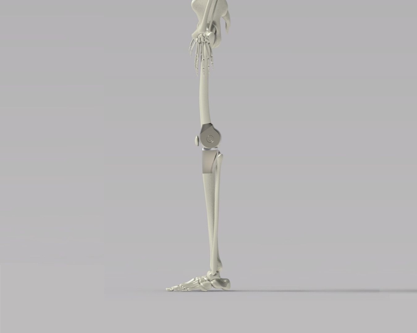 knee tumor prosthesis 3D https://p.turbosquid.com/ts-thumb/GP/VChZEO/J4FWe8tq/kneetumorprosthesis7/jpg/1572164694/1920x1080/fit_q87/44cc1b1f941c6a91a1f7326e632a7a645b3d35ba/kneetumorprosthesis7.jpg