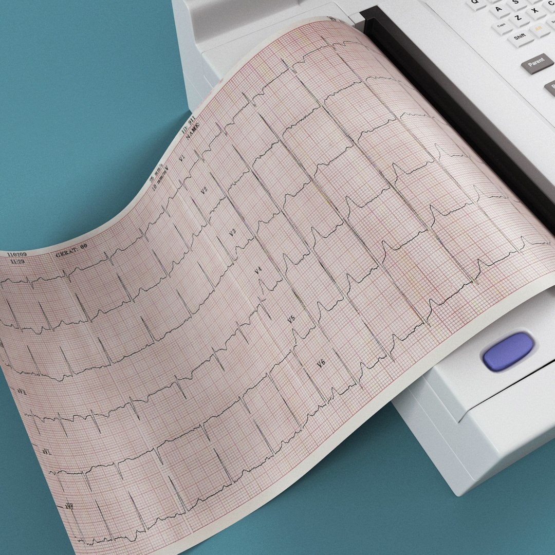 3d electrocardiograph fukuda denshi https://p.turbosquid.com/ts-thumb/GT/w0UAgj/T0rrTTec/electrocardiograph_fukuda_denshi_07/jpg/1315985702/1920x1080/fit_q87/297dba3b70af6f55638a4b745669bf411bf2946c/electrocardiograph_fukuda_denshi_07.jpg