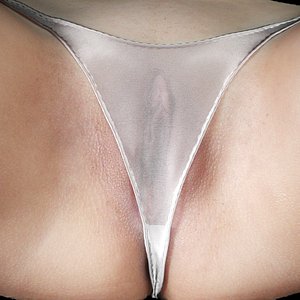 Scan Vagina 001
