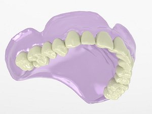 3D upper denture model