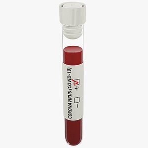 test tube model