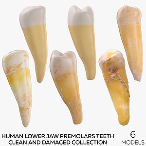 3D Human Lower Jaw Premolars Teeth Clean and Damaged Collection - 6 models