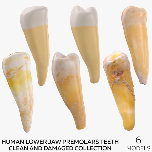 3d human lower jaw premolars teeth clean and damaged collection