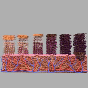 cervical cancer cin 3D model