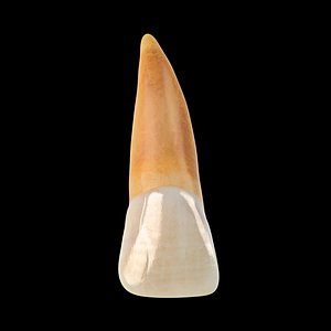 Upper Central Incisor Tooth