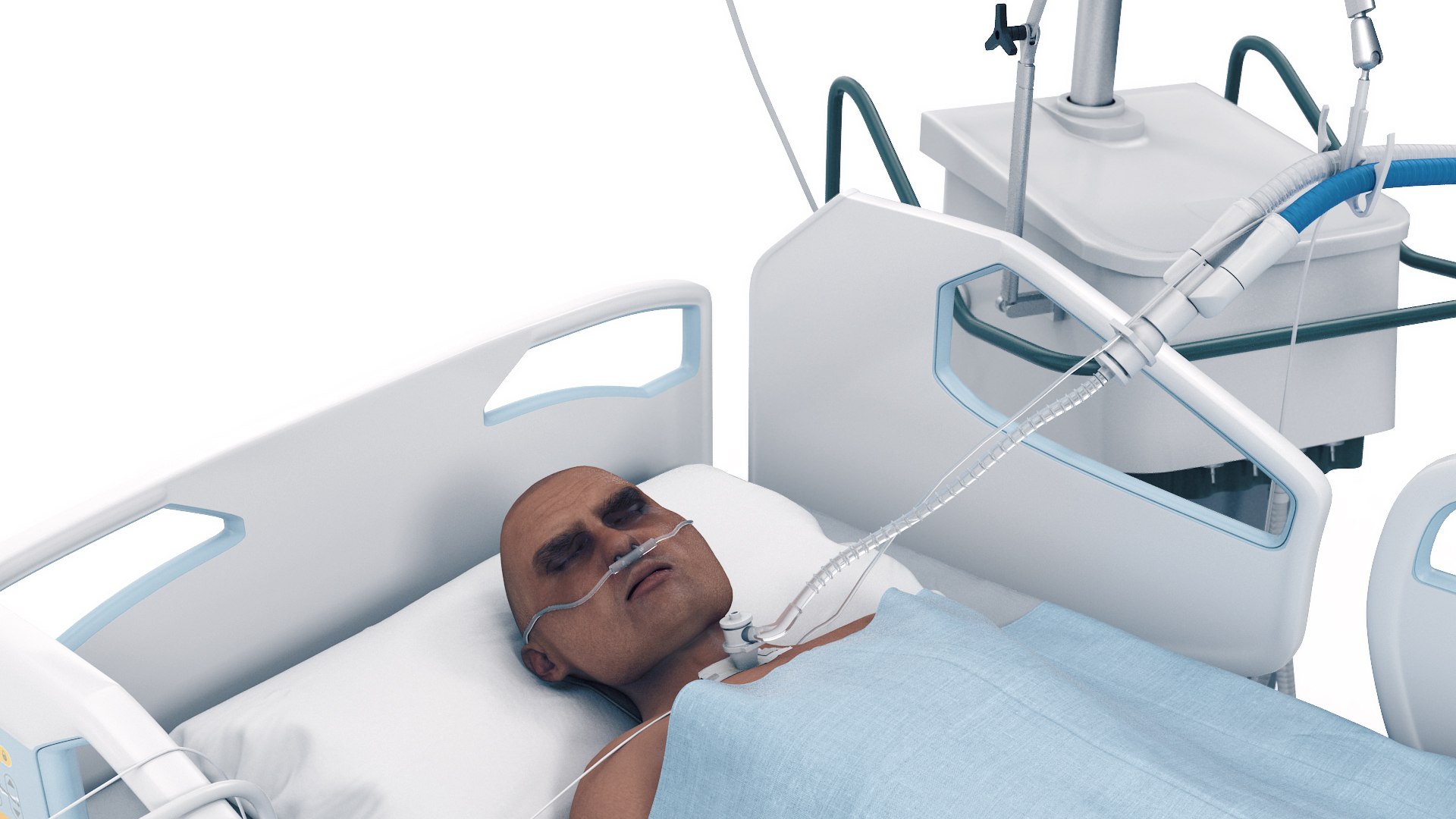 3D Patient in Intensive Care model https://p.turbosquid.com/ts-thumb/H6/peWnCS/EA/icupatprev5/jpg/1694940298/1920x1080/fit_q87/08d48fcbf29ec31c9ec31f932de509f07ca615bc/icupatprev5.jpg