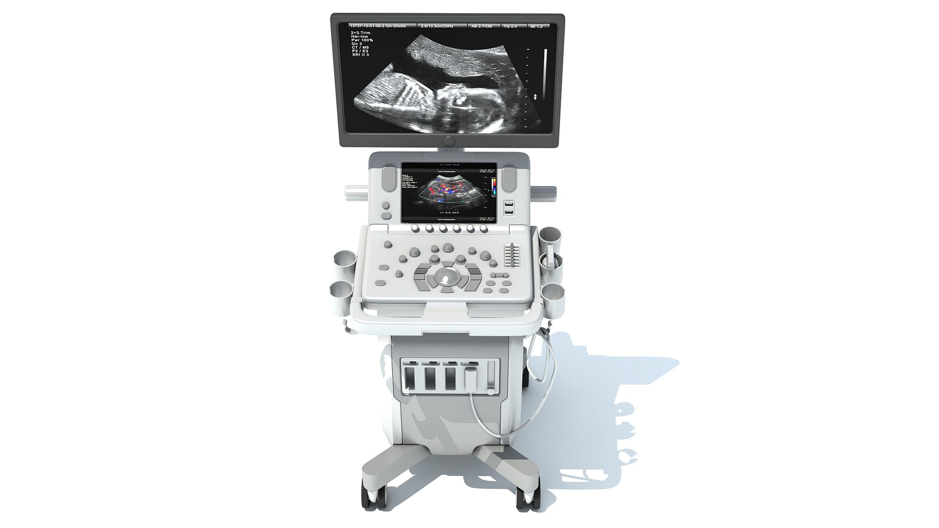 On Platform Ultrasound System Model - TurboSquid 1778809