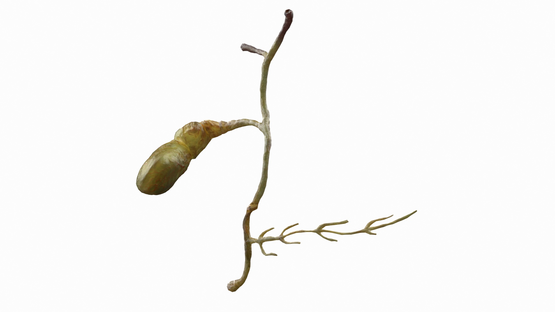 3D human gallbladder gall model https://p.turbosquid.com/ts-thumb/HE/DB4qLR/8RJRLdo2/human_gallbladder_system_360/jpg/1572258909/1920x1080/turn_fit_q99/088f8852d678f622615624ad8e61a0067397ab20/human_gallbladder_system_360-1.jpg