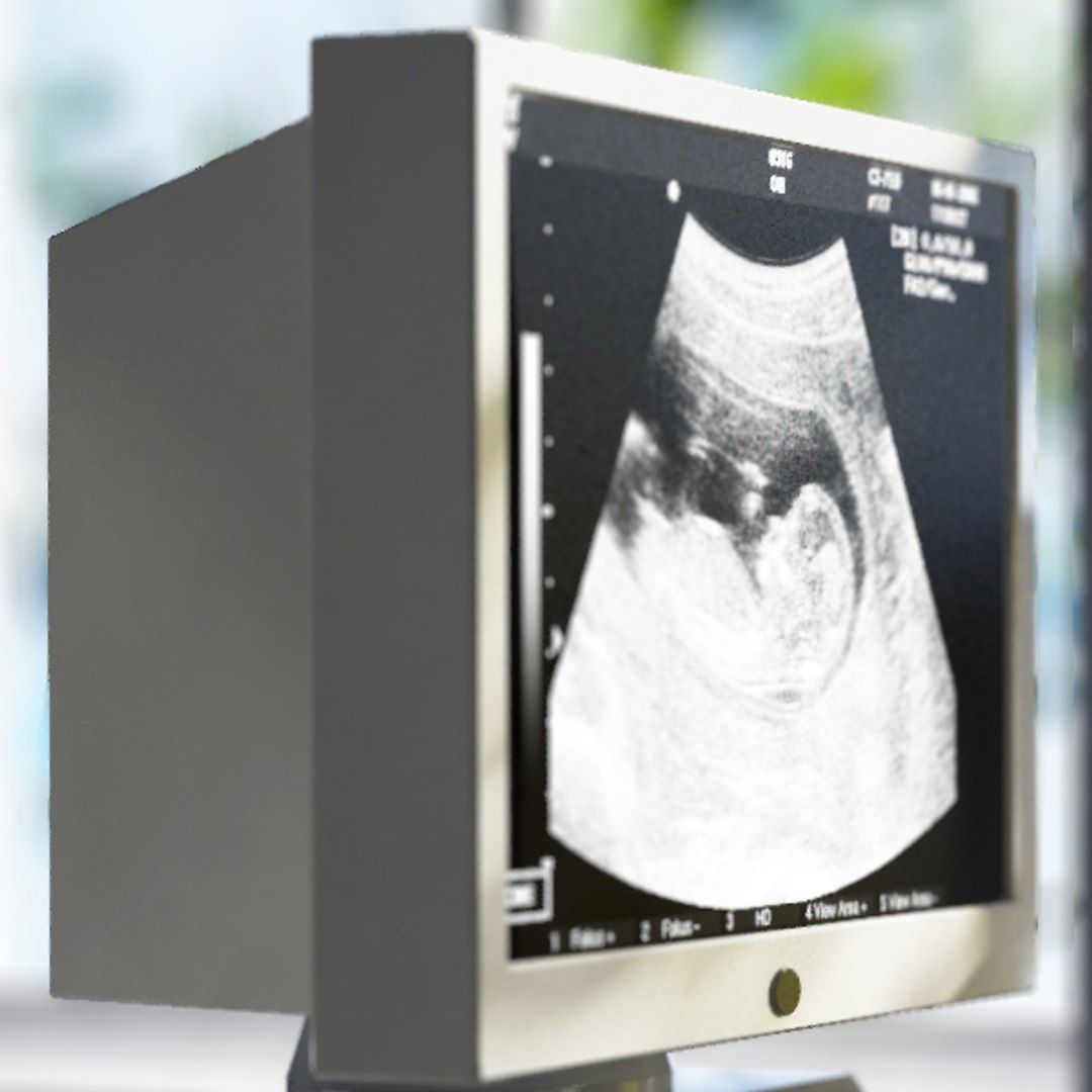 lego pregnant https://p.turbosquid.com/ts-thumb/HH/woXJIW/Hn2JJIBv/04/jpg/1416594400/1920x1080/fit_q87/18f3c538480233703c933318b174ec3a98a93aec/04.jpg