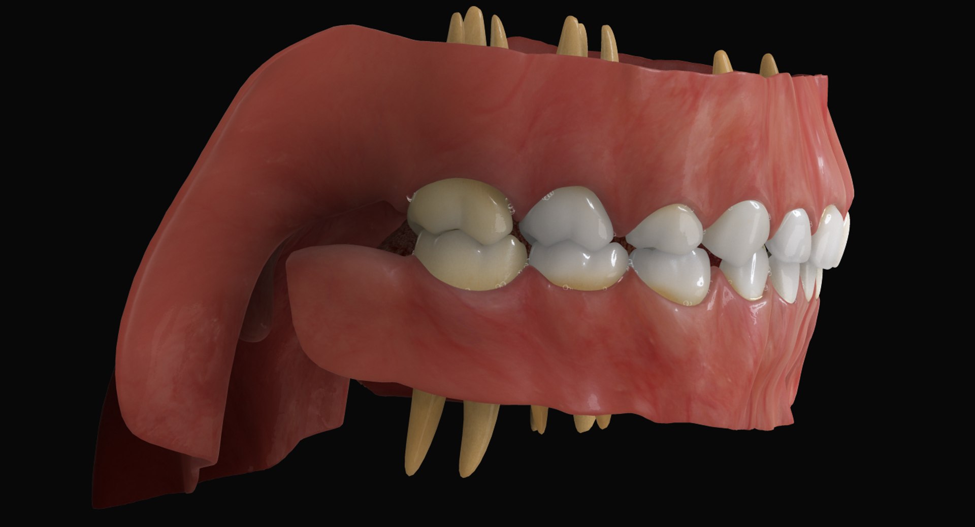 3ds max mixed dentition mouth tongue https://p.turbosquid.com/ts-thumb/HN/RP2eeW/QLFC9RPF/mdg_side/jpg/1441278192/1920x1080/fit_q87/c13dfe902204ca1952dddb7c3c11c2e601b8bdc2/mdg_side.jpg