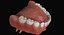 Mixed Dentition