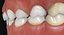 3ds max mixed dentition mouth tongue