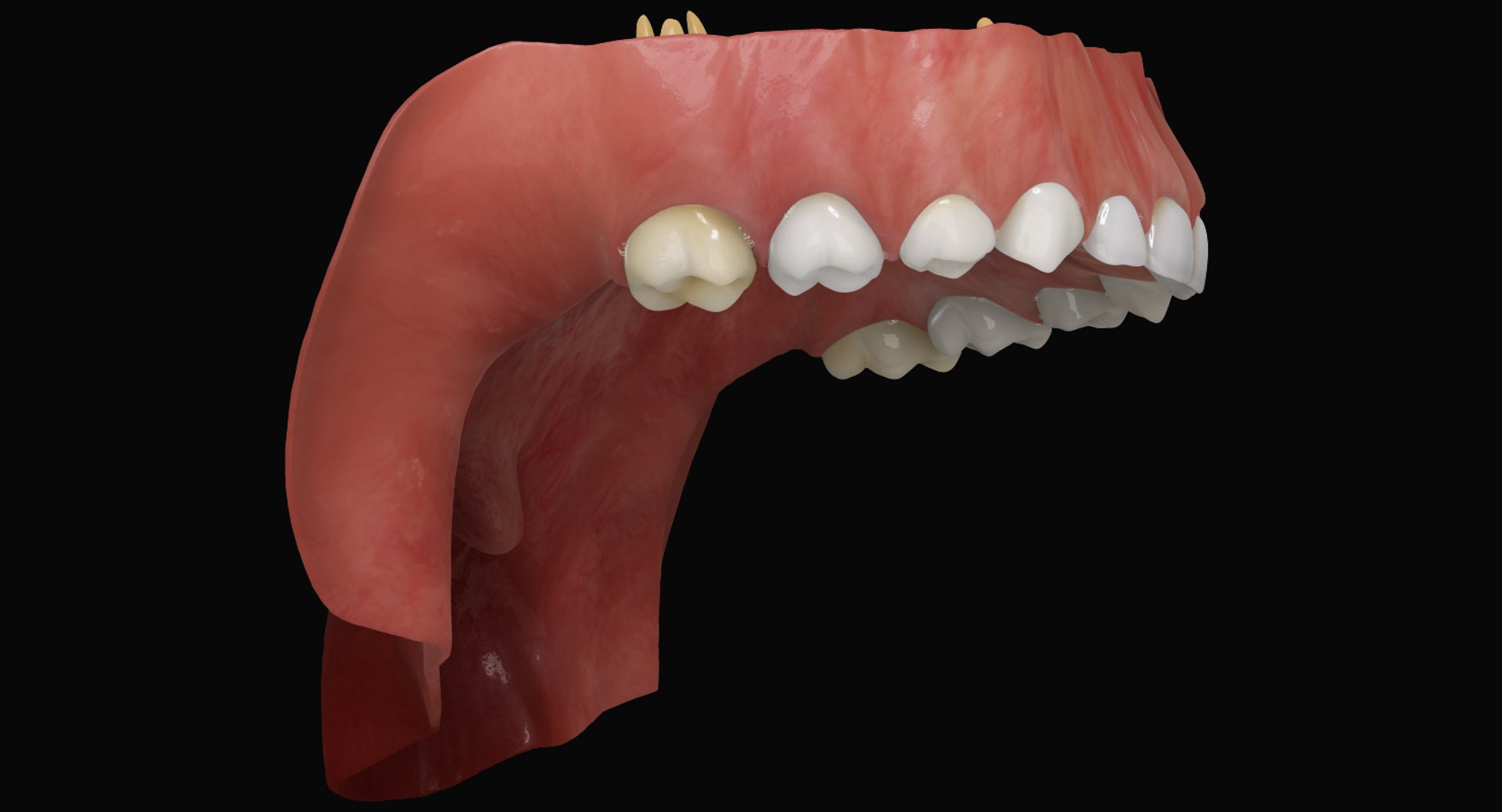3ds max mixed dentition mouth tongue https://p.turbosquid.com/ts-thumb/HN/RP2eeW/YT2XMPIr/mdg_03/jpg/1441278192/1920x1080/fit_q87/5bf502ef9b09e619b1607f3dd4a4d2780f2799c9/mdg_03.jpg