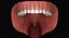 Mixed Dentition