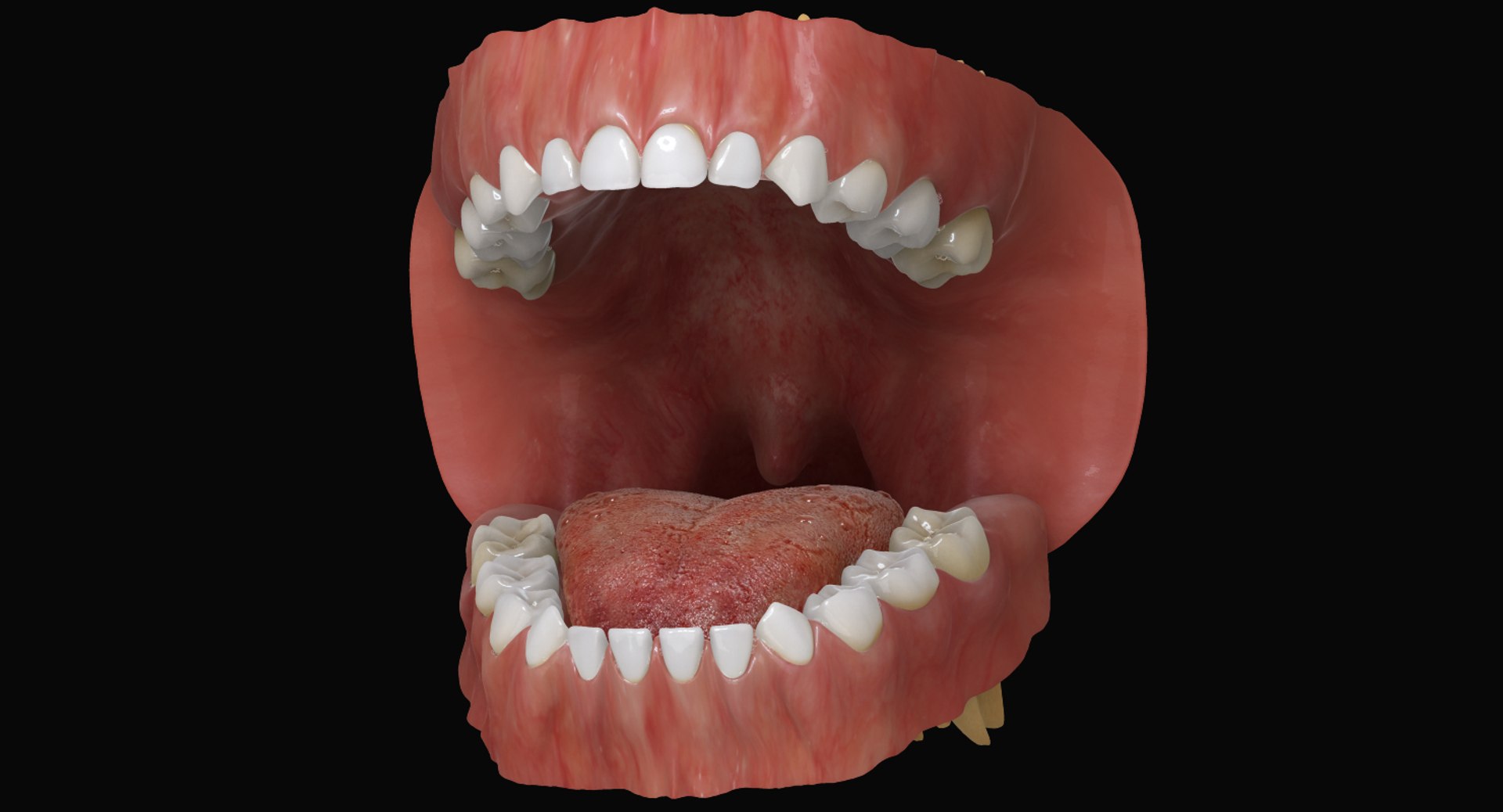 Dental Creations Wonderfill Tongue and Void Filler Pre-Mixed Dental Model Tong