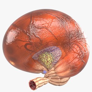 Volvulus intestine obstruction 3D