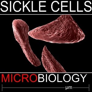 3d model of blood cells sickle anaemia