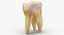 Human Molars Teeth Clean and Damaged Collection - 14 models 3D model