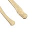 Ulna Bone