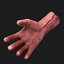 Severed Arm