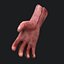 Severed Arm