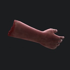 Severed Arm