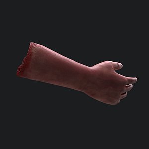 Severed Arm