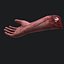 Severed Arm