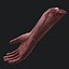 Severed Arm