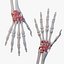 Wrist Joint Ligaments