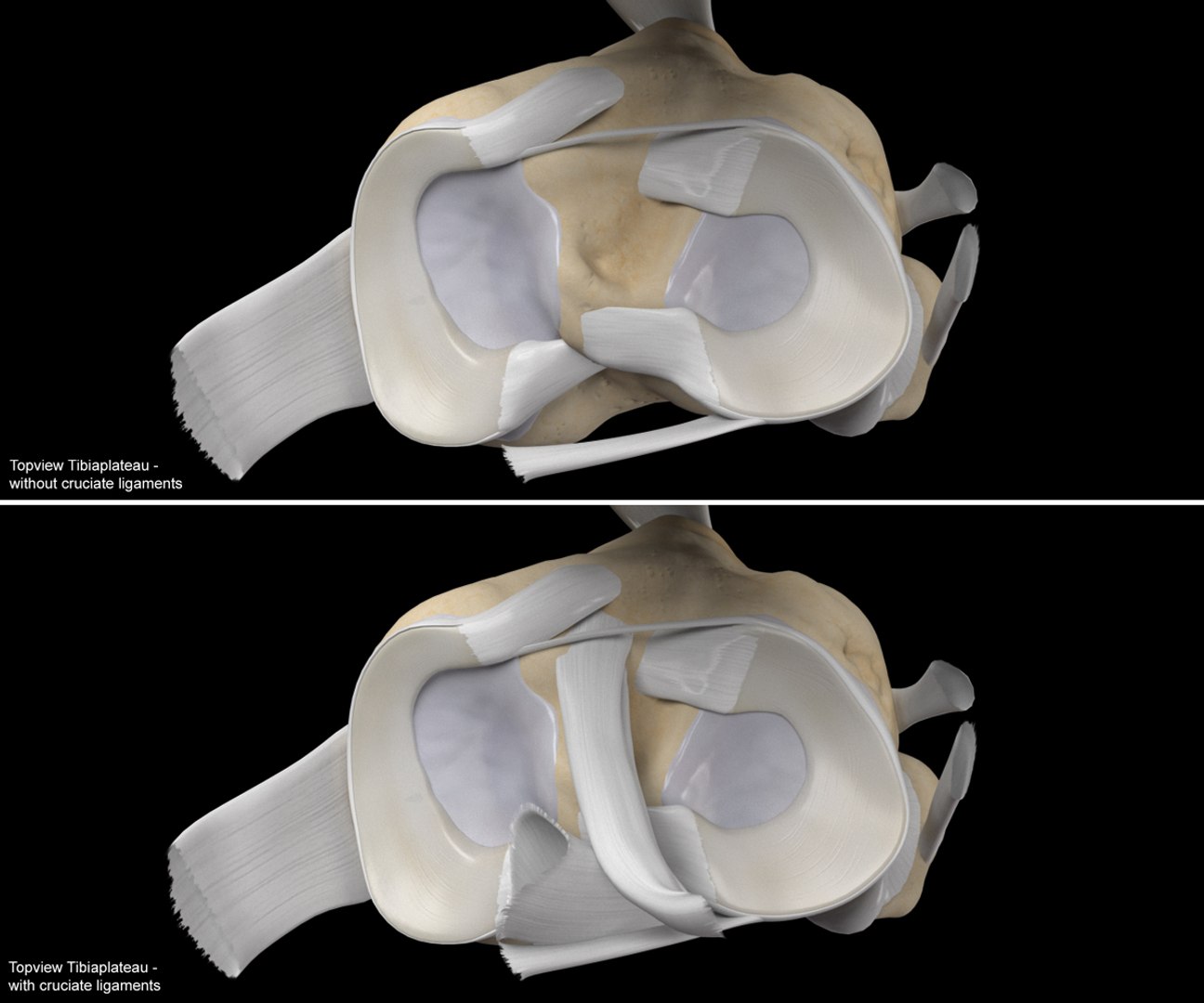 High Resolution Human Knee  from a real CT-Scan model https://p.turbosquid.com/ts-thumb/IV/0uMWHK/Tw/final_kneehr_topviewtibiaplateau/jpg/1685099650/1920x1080/fit_q87/80cd675522fe3472563cdc0e3b5269d10456e320/final_kneehr_topviewtibiaplateau.jpg