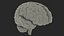 Ologramma cerebrale a raggi X