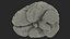 Ologramma cerebrale a raggi X