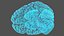 Ologramma cerebrale a raggi X