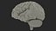 Ologramma cerebrale a raggi X