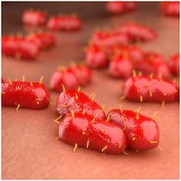 Bacterial Meningitis