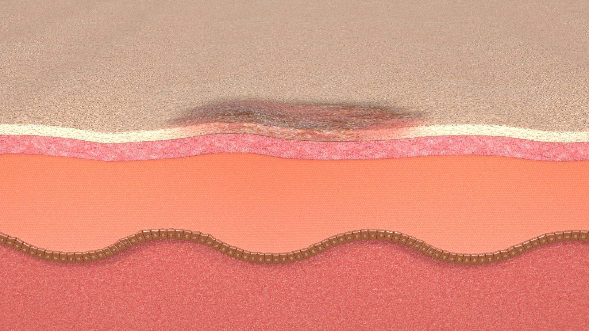 Skin Healthy 3D Model TurboSquid 1580099