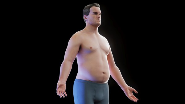 modelo 3d Human Anatomy Obese Male Body - TurboSquid 2028908