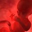 Human Fetus 18 Weeks