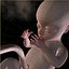 Human Fetus 18 Weeks
