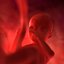 Human Fetus 18 Weeks