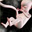 Human Fetus 18 Weeks