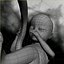 Human Fetus 18 Weeks