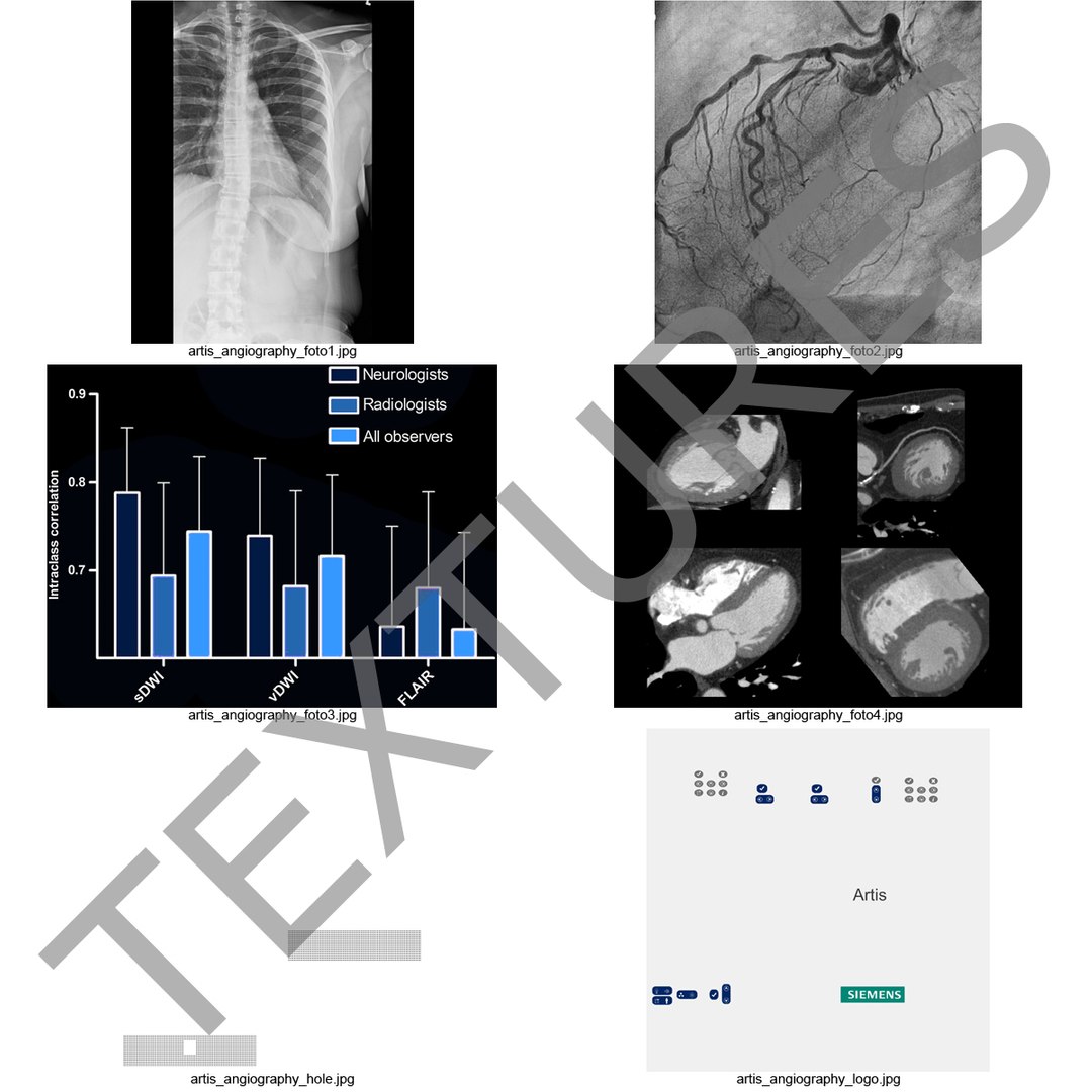 artis angiography 3d 3ds https://p.turbosquid.com/ts-thumb/JG/Ss6Yx8/pLSfSvJg/artisangiographysystem_192/jpg/1400709031/1920x1080/fit_q87/33c46781e0828682540347369edc786cf93da2d0/artisangiographysystem_192.jpg