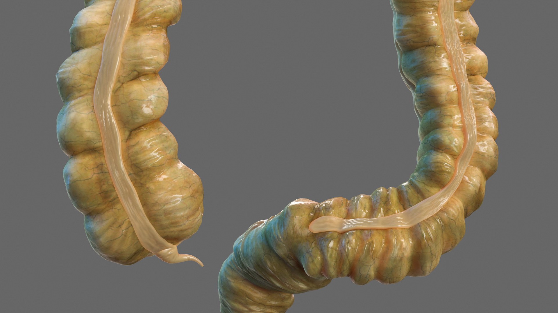 3D human small inestines colon model - TurboSquid 1469288