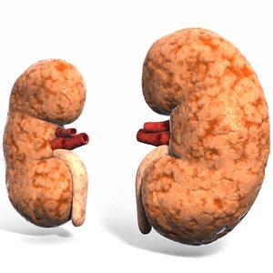 3d model of kidney